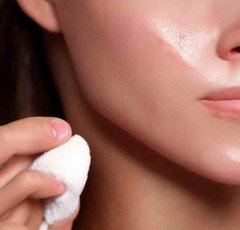 How to Treat Acne ?