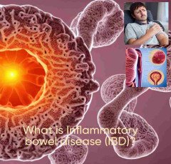 What is Inflammatory bowel disease (IBD) ?