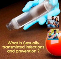 What is Sexually transmitted infections and prevention ?