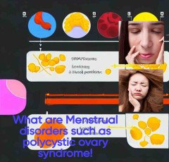 What are Menstrual disorders such as polycystic ovary syndrome (PCOS)?